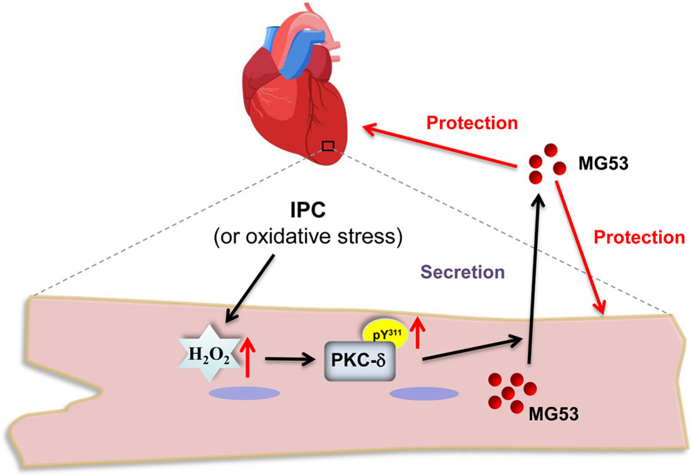 CircAHA's tweet photo. Ischemic preconditioning (IPC) is the most powerful intrinsic protection against cardiac ischemia/reperfusion injury and promotes MG53 secretion through H2O2-Activated PKC-δ signaling. Learn more: https://t.co/YAz0m40XDK #AHAJournals https://t.co/LEMAqgvgE2