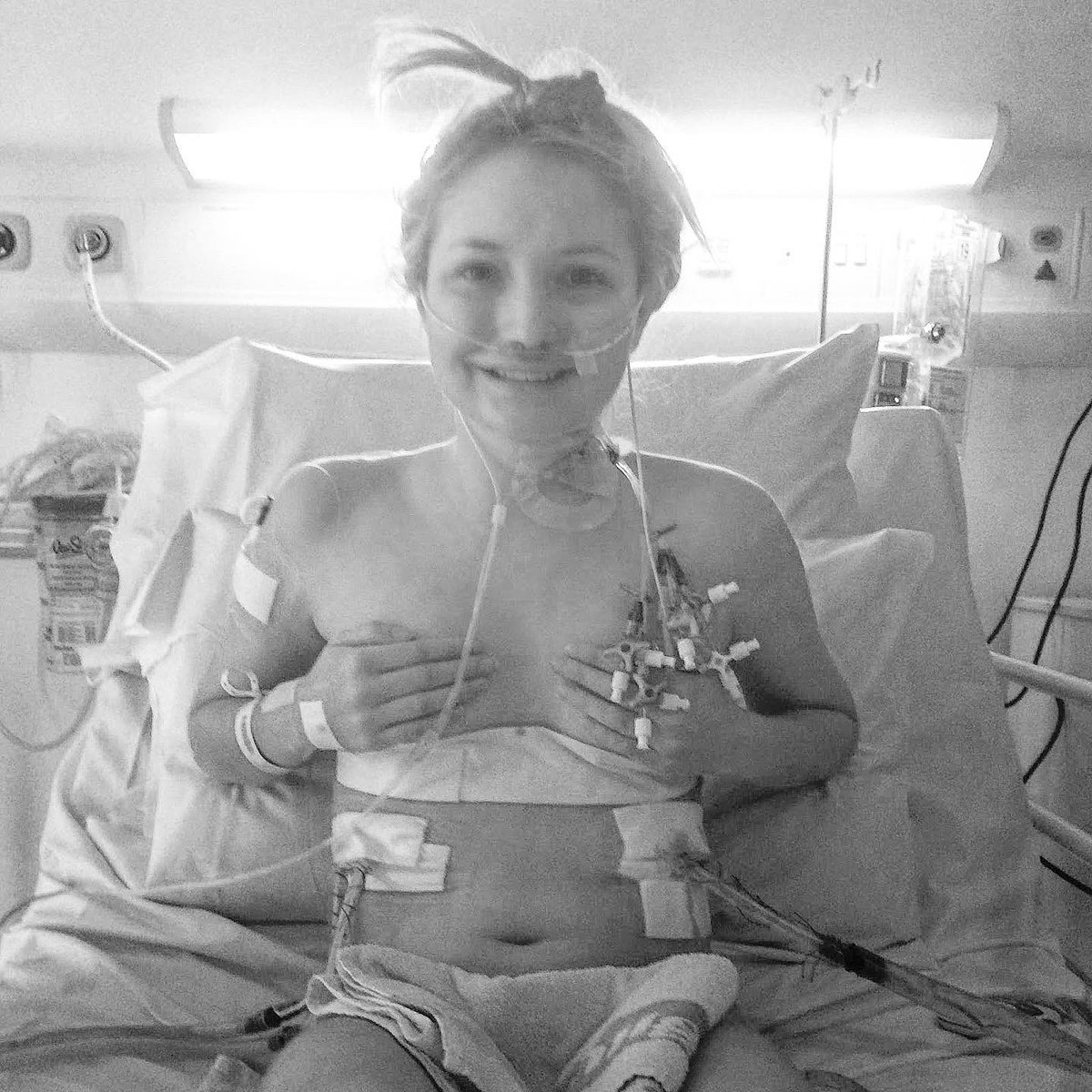 hollyrosanna's tweet photo. 5 years, 6 months and 27 days of extra time thanks to my organ donor. The scars may fade but the gratitude I feel for my donor and medical teams for saving my life just continues to grow as time passes, time I didn’t think I’d have. #livelifegivelife #organdonation #doublelung https://t.co/n0Dfau6T6v