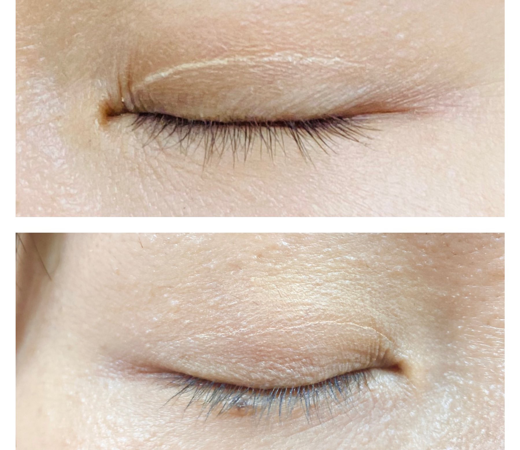 りす 過剰皮脂 毛穴と共存する人 オイリー肌で常にまぶたがチュルチュルしてるおかげで日焼け止めやメイクが二重の線 にすぐ溜まってしまうのが悩みなんだけど 幼稚園往復の30分で白い線になる Polaのディエムクルールコンシーラーをまぶたに軽くのばしたら