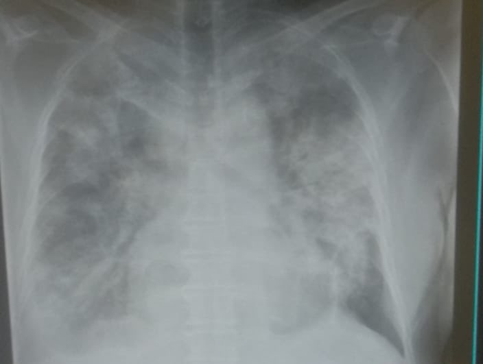 MediCasos's tweet photo. Sin ofender a algún paciente o a una familia o exponer algo. 

¿Tienen una foto que haya marcado su vida como estudiante, médico interno o residente?

Esta es la mía: primer paciente que atendí de COVID-19. https://t.co/heAQUZb7vo