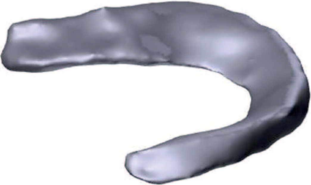 BoneJointRes's tweet photo. This paper reports the preliminary findings of the production of a custom-made, cell-laden, collagen-based human #meniscus. The prototype described could act as the starting point for future developments of this structure https://t.co/EJU5TpxQm4 #3dprinting https://t.co/ZGlNMYxc0W