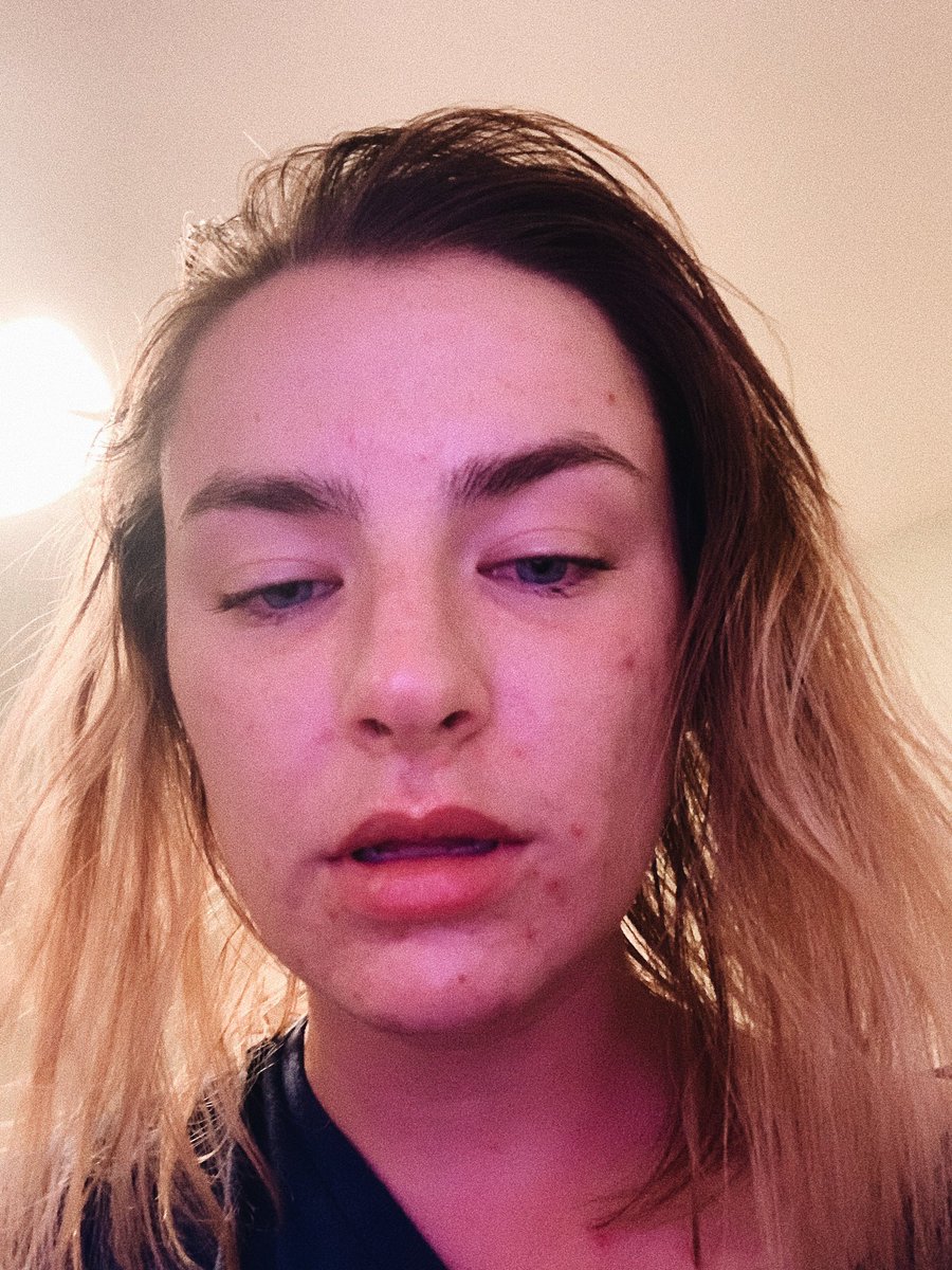 We love to see that 24 hour change in appearance 😋❤️