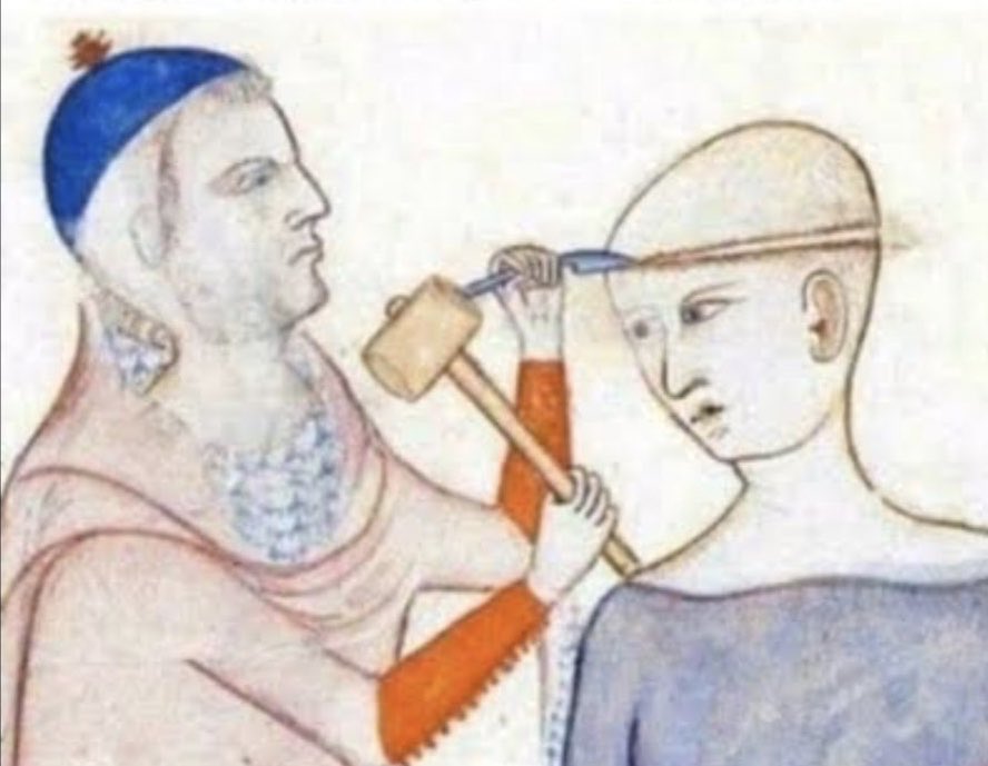 Beyin ameliyatınızı nasıl alırsınız. İkisinin arasındaki fark GÜÇLÜ TIBBİ CİHAZ SEKTÖRÜ ile çalışabilmektir. #Tibbicihaz #tıbbicihazyaşatır