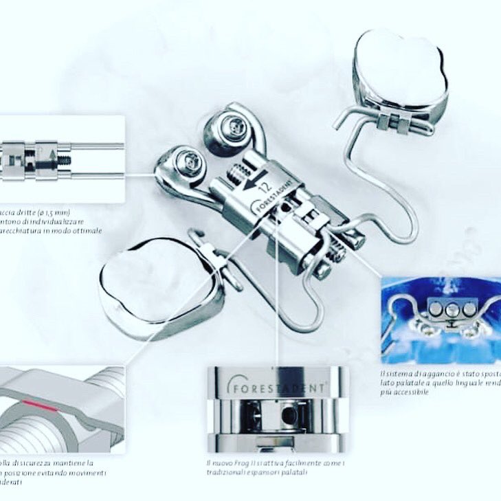 SavianoSrl's tweet photo. 🔩⛓🔩ORTHOEASY🔩⛓🔩

Ancoraggio scheletrico palatale con le Orthoeasy Forestadent .... molto più semplice di quanto tu possa immaginare ...
Per maggiori info non esitare a contattarci 
📞——>  +39 327 8509825 (anche whatsapp )
 💻——> info@savianosrl.it  

https://t.co/MqOFIBd6ls https://t.co/NudLseZ54P