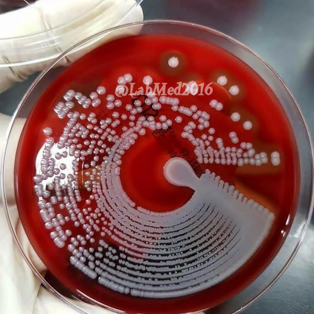LabMed2016's tweet image. هذه الطريقة من التزريع ،استخدمت فيها تقنية حديثة تسمىPREVI ISOLA .
✅🔬 انضم إلينا: 👇
#الطب_المخبري