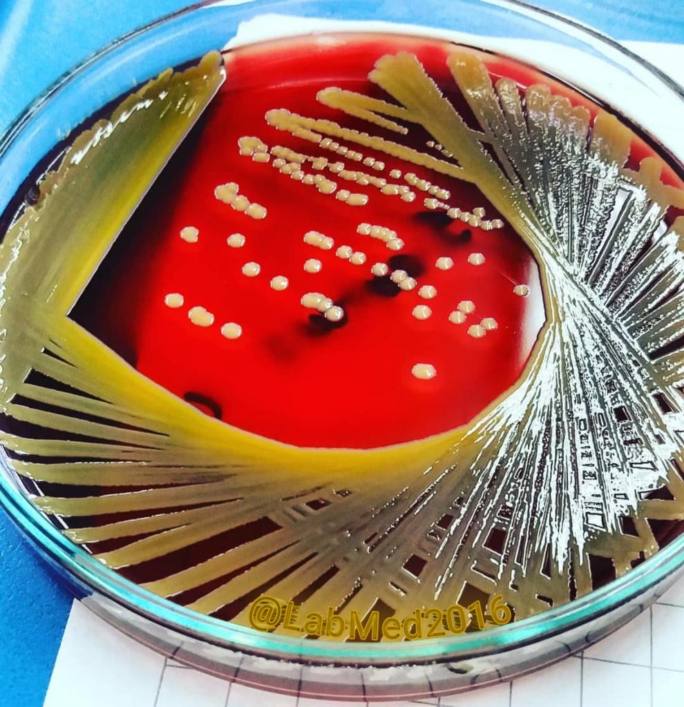 LabMed2016's tweet image. من اول مشاهدة لهذه الصورة وكانها لملعب كرة القدم التقطت من اعلى ،
لكنها في الحقيقة هي الذهبية الجميلة👈Staphylococcus aureus
زرعت على Blood Agar. 
#الطب_المخبري