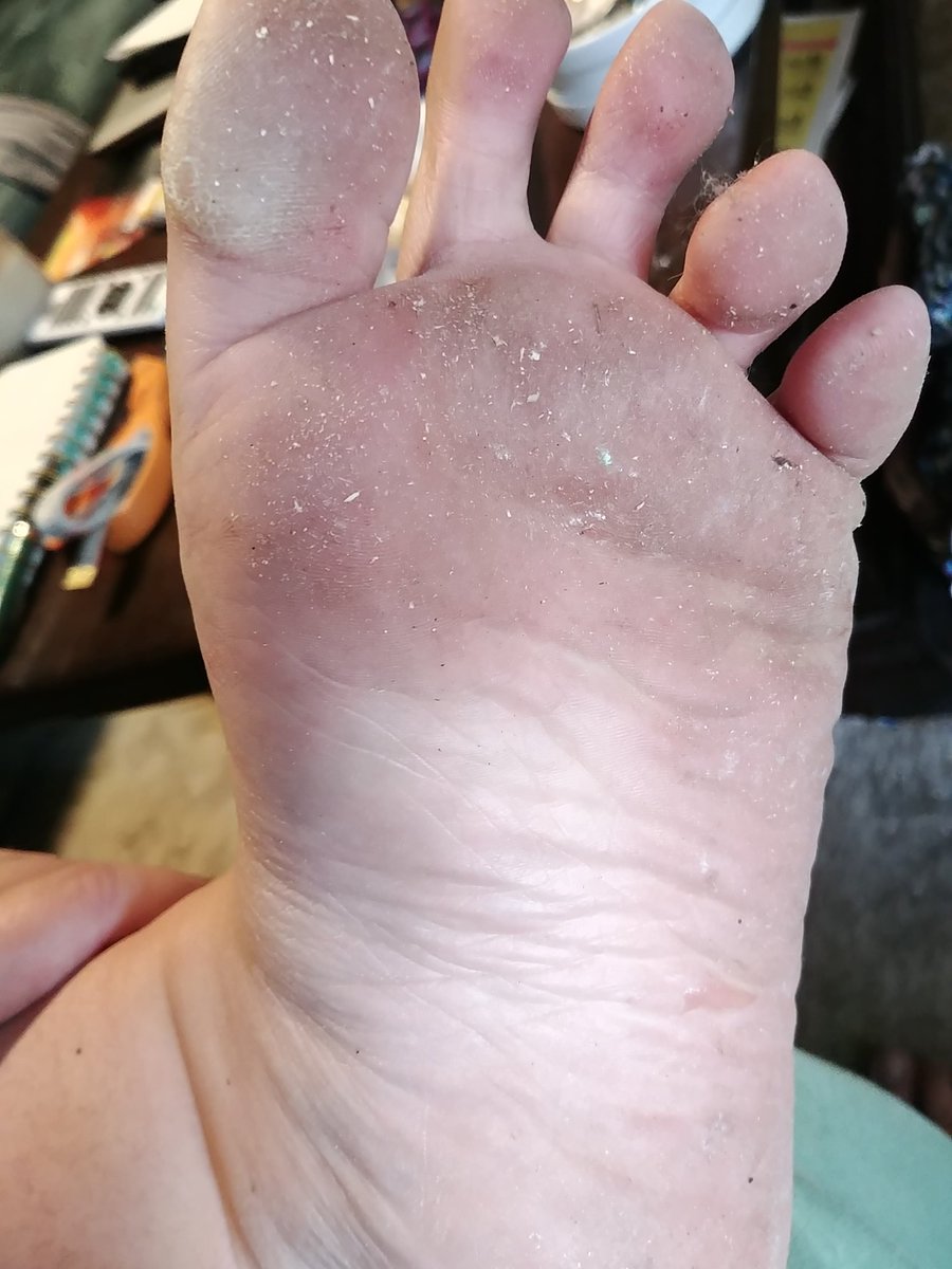 Let's play a game of 'Can You Spot The Glass In My Foot'. First one to guess correctly gets a free personal pic that no one else gets to see!
#dirtyfeet #steeltoes #walkingonbrokenglass #contest