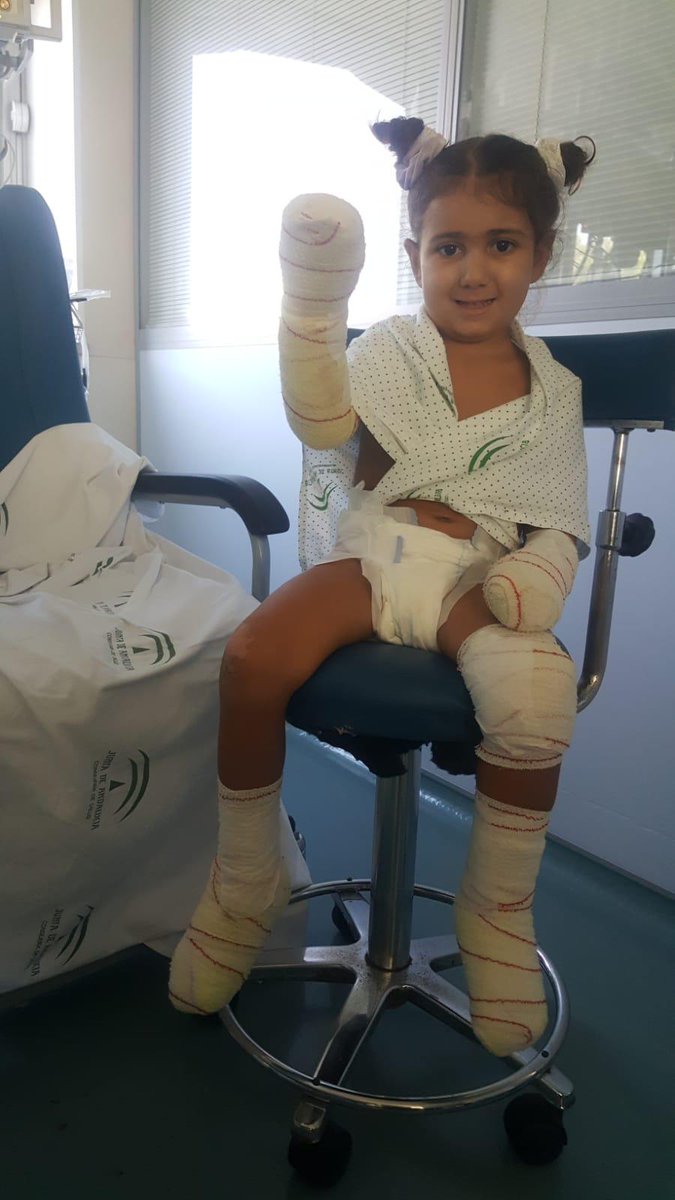 Alguntiodeporah's tweet photo. Mi prima de 4 años ha estado muy grave en el hospital y tras una sepsis, le tienen que amputar las 4 extremidades. Desde una clínica privada han asegurado que le recuperan las 2 piernas y una mano pero no se lo pueden permitir. Cualquier ayuda es agradecida ♥️
Insta:carlota.gl16 https://t.co/ItPUn0XZt5