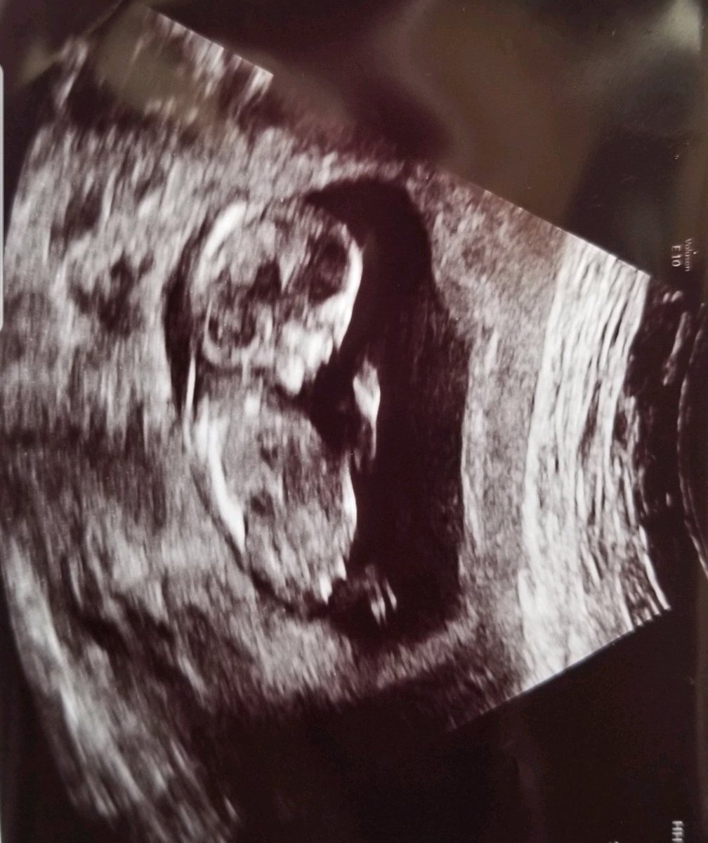 the4thdave's tweet photo. "S'up."
--#BabyNumberThree https://t.co/KnF2liLeoz