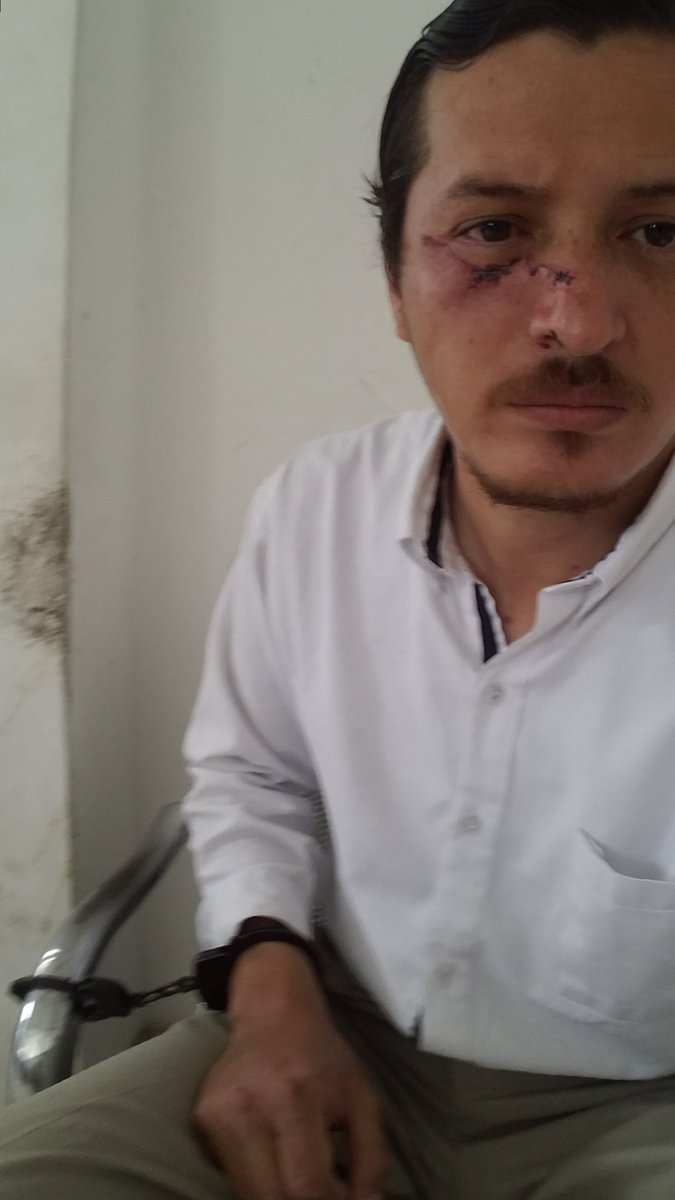 StalynNolivos's tweet photo. Urgente cambio de sistema de justicia !!
3 delincuentes entran a mi propiedad, me atacan, logran darme un machetazo en la cara. Me defiendo con todo mi arsenal. 
Los sacan en ambulancia,  camilla y cuello ortopédico y a mi me detienen. https://t.co/Gv6t76jkwI