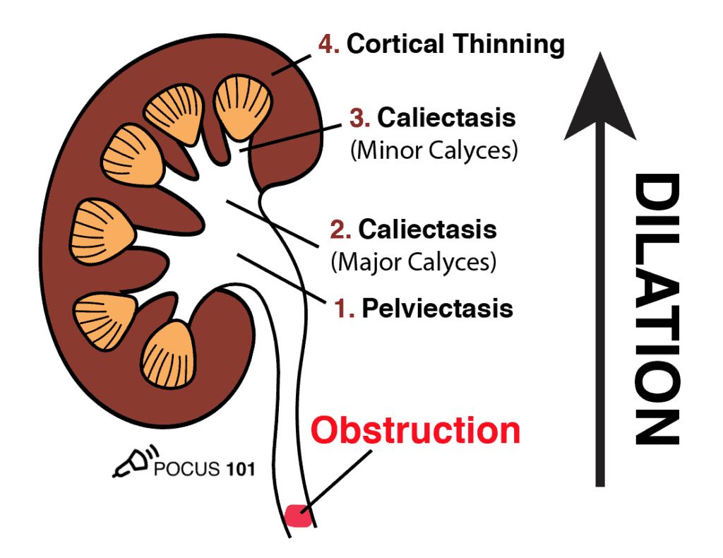 tired-of-irradiating-your-patients-with-ct-scans-learn-renal