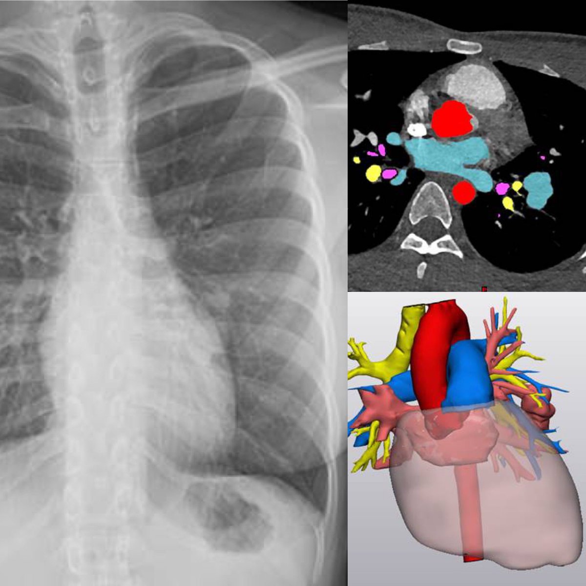 Jay Morris tweet media