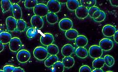 235) Once the host’s native microzymas are destabilized, they proceed to decompose host tissue via the creation of “pathogenic” bacteria, which essentially operate like scavengers.