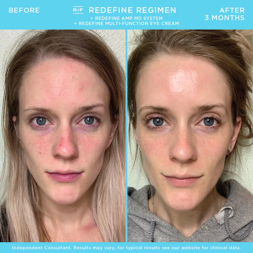 rodan and fields eye cream results