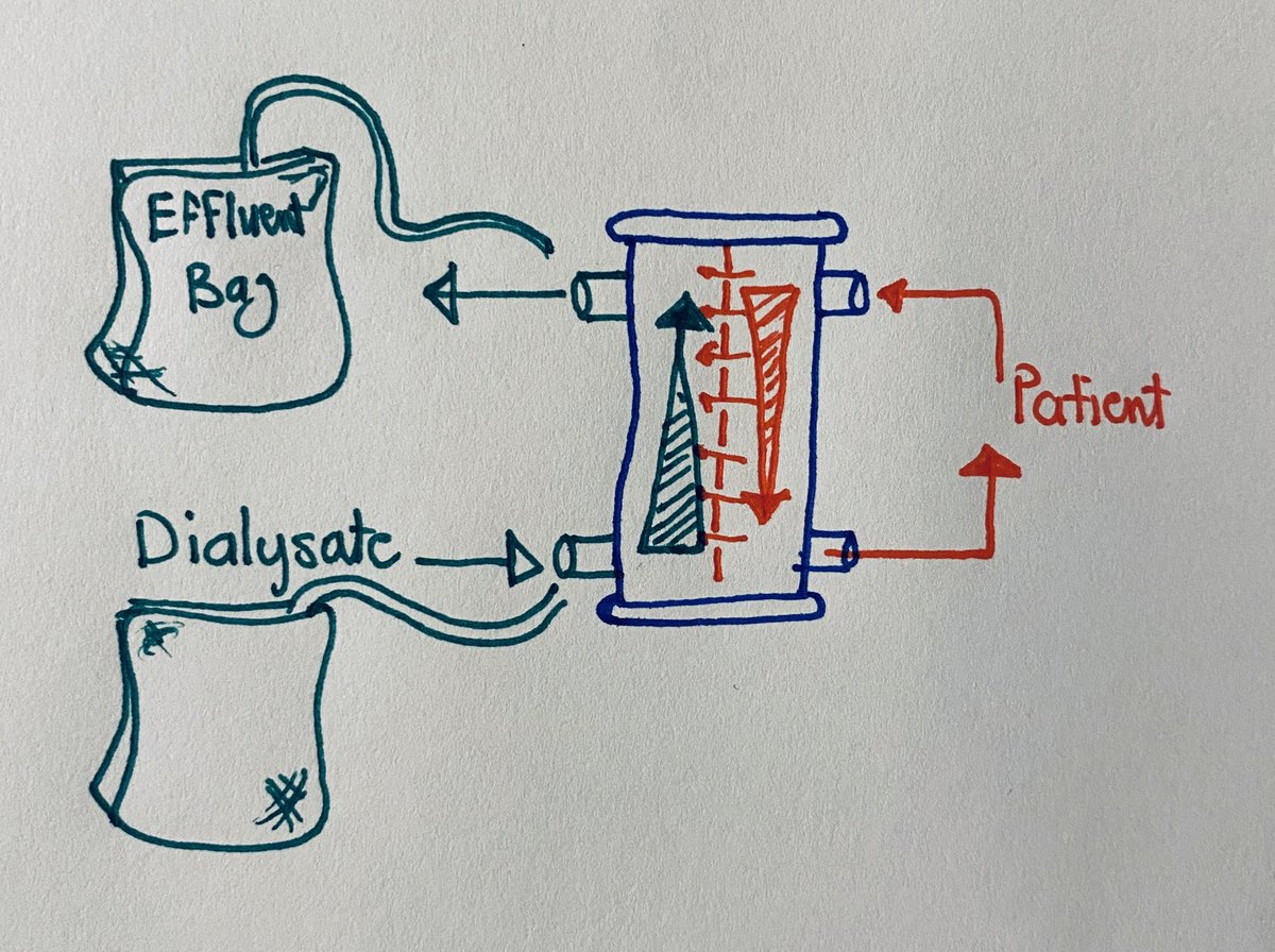 Diffusion; blood from the Pt to the filter, In the same time there is another fluid called the Dialysate goes in the opposite way of the filter around the blood which the solutes start the exchange according to the gradient difference and then go out to the effluent bag