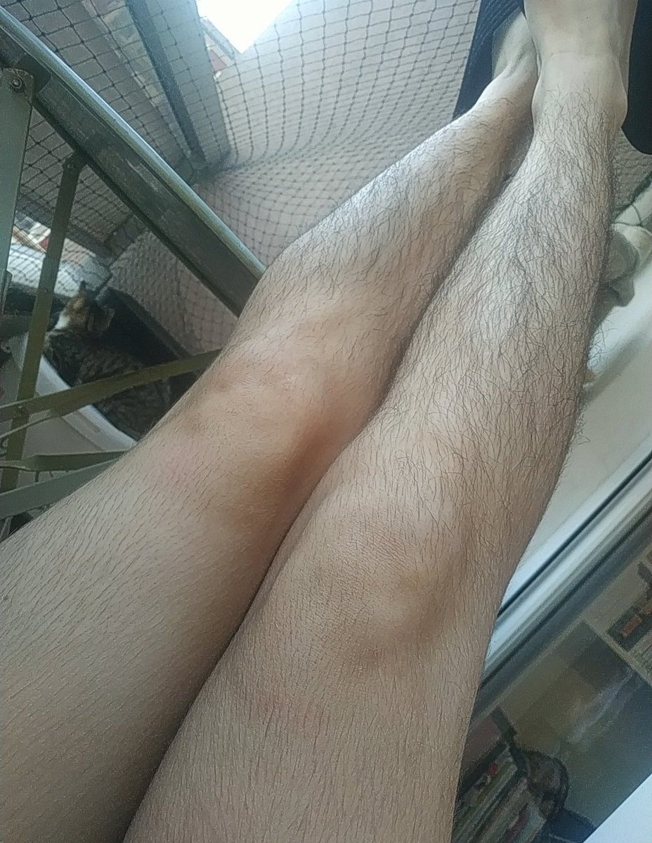 LaChroNiqueTM's tweet photo. Yo fam #jegardemespoils et je vais au contact de tous ceux qui m'insultent dans la rue, donc les Jean Mi sur internet 🤧🤧🤧 could not care less. Bref courage personne ne devrait être obligée de correspondre à des critères de beauté, quels qu'ils soient https://t.co/4lLtVXzVar