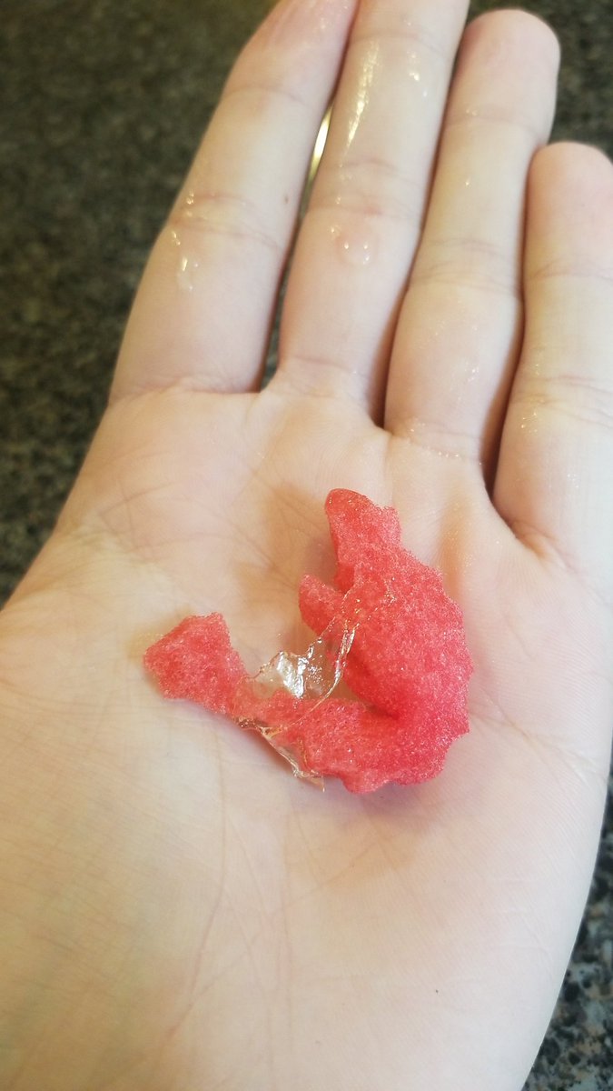 raringfostar's tweet photo. This is a 2 month old fetus!! And some of you say this isnt a human yet?!?! It has ARMS already!! ABORTION IS MURDER!! https://t.co/UN6MLhXvps