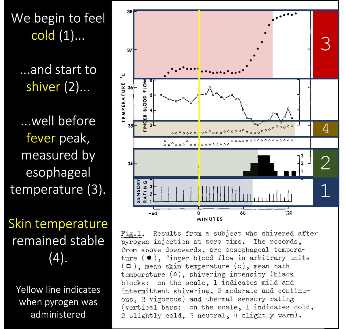 6/In one study, subjects were placed in water at a stable temperature and injected with a pyrogen.Before fever, they felt cold. This was despite a stable skin temperature. chills must therefore arise from some central action of pyrogens https://pubmed.ncbi.nlm.nih.gov/7189863/ 