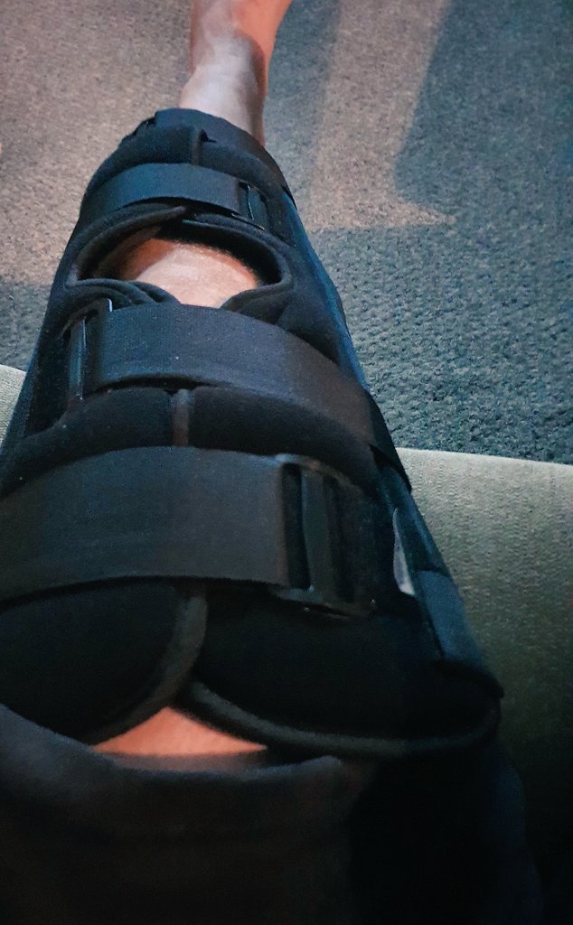 autismdad82's tweet photo. Hi everyone. Been a uncomfortable few days. Popped my knee on Thursday last week, thought nothing of it until yesterday. I couldn't stand up or straighten my leg. Went A and E and I've torn my meniscus in my knee. #Foff2020 https://t.co/ca6CrRqzRK