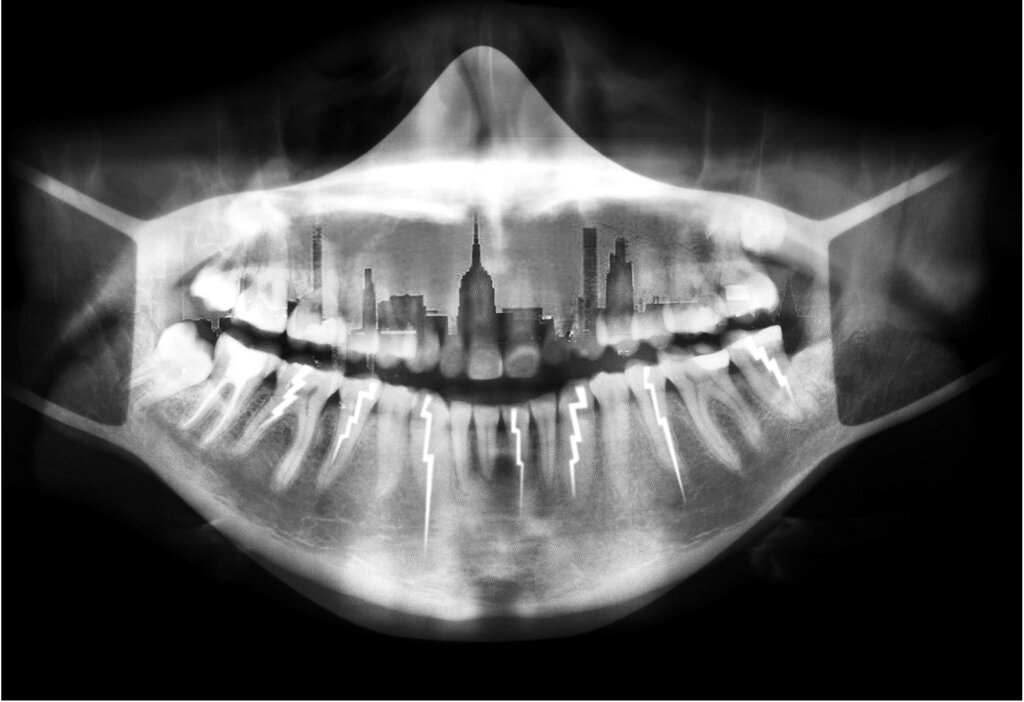 PHASEIV's tweet image. Cracked Teeth and Covid /  Why Does Your Shoulder Hurt? / Yahoo Magazine The Workout That Changed Your Life at PHASE IV - mailchi.mp/forsterphysica…