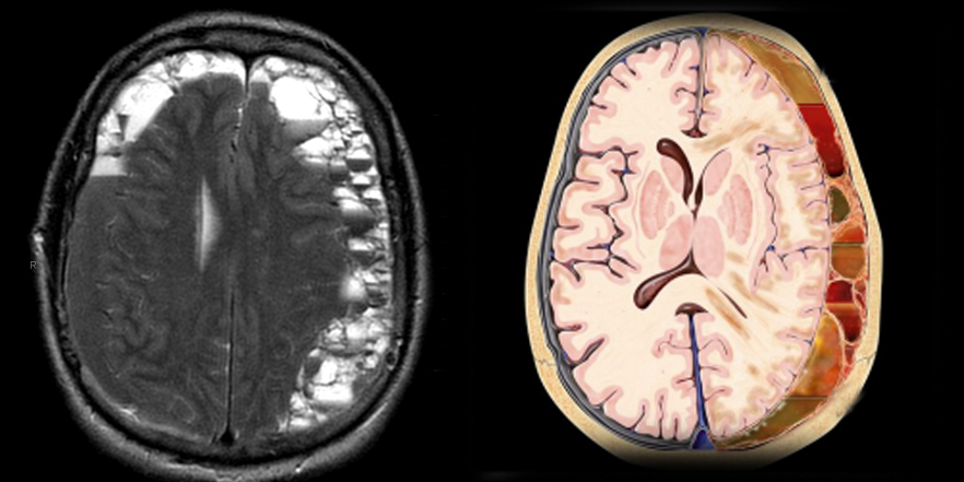 Philip R. Chapman, MD tweet media