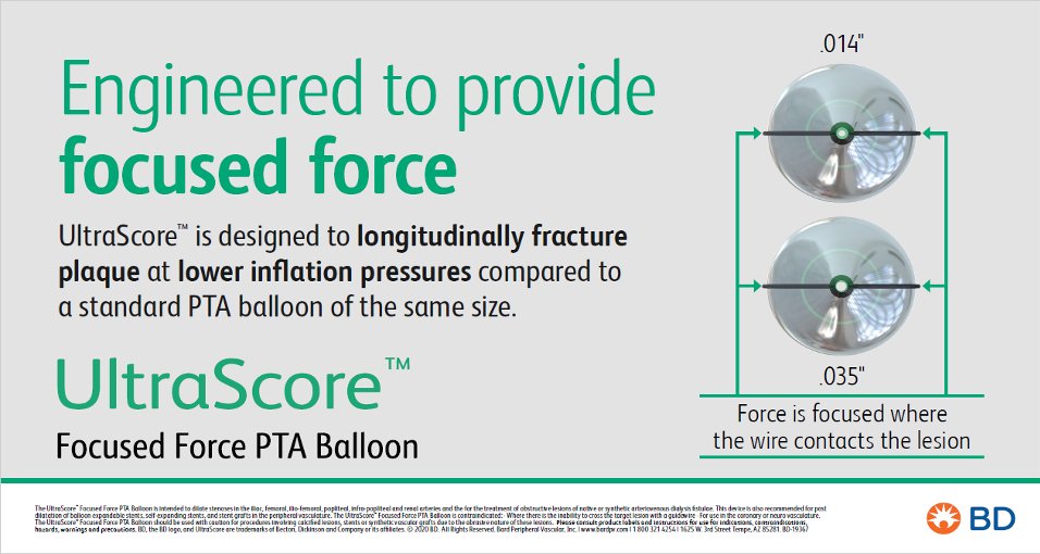 The UltraScore™ Focused Force PTA Balloon and its #FocusedForce technology are designed for controlled plaque modification. For important safety information from BD, please visit: bit.ly/30Zeo18