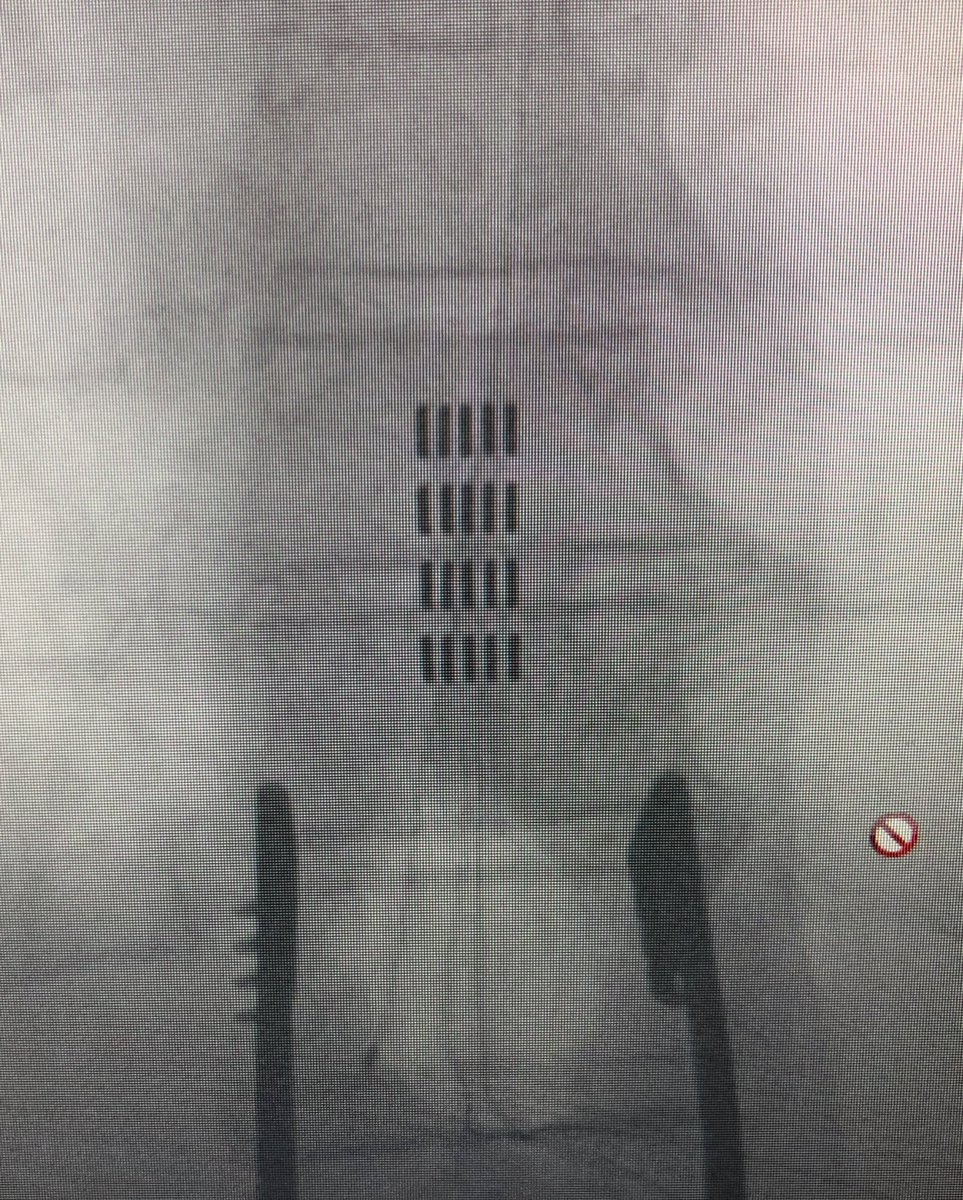 jdavanzomd's tweet photo. Day 1/7 of a neurosurgeon’s life in pictures. No description. @AHNtoday Nominated by @BradZachariaMD I nominate @NBrandmeir https://t.co/hgqoWRZkD5