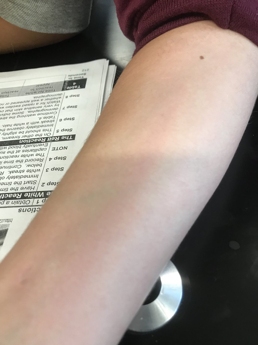 #1DCCS #anatomy Anyone that’s visited today’s anatomy lab would have truly thought we were mad scientists as we performed various experiments on ourselves to test our skins physiological responses to disturbance.