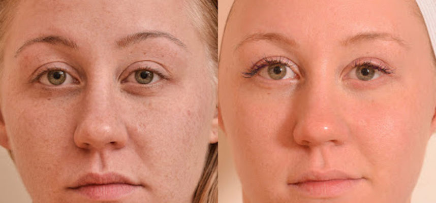 WivesMag's tweet photo. https://t.co/zwA1ZmpfRq
#tannedskin #tannedbody #tanning #Tanner https://t.co/TIxIY65svp