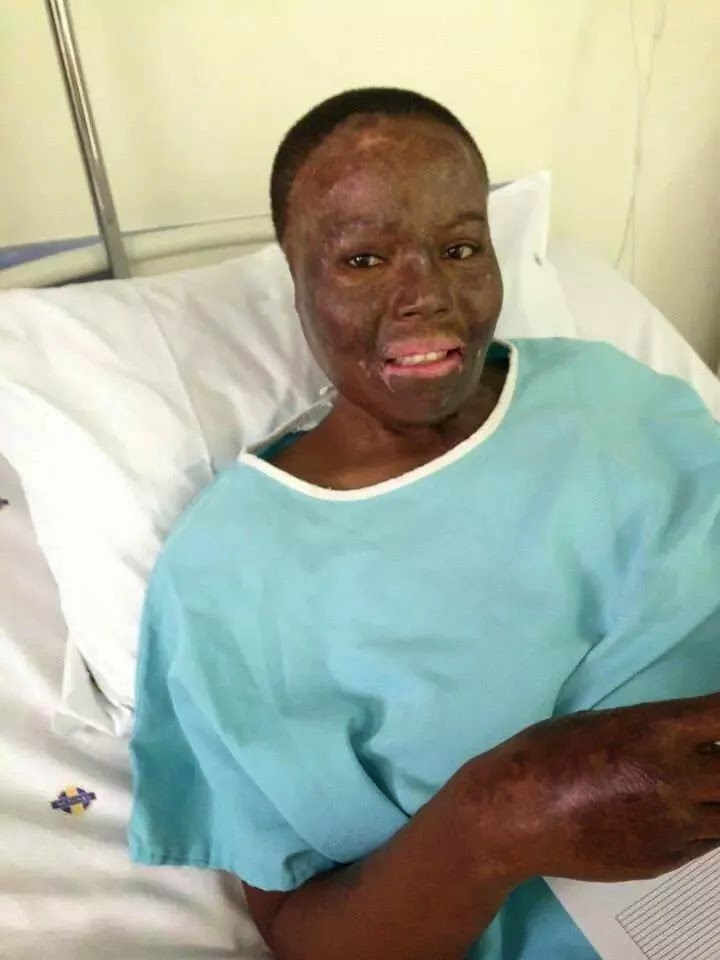 Misst_Thembs's tweet photo. We had an argument,  the next thing he decided to play God with our lives

He dosed us with petrol fought with him so he cant ignite the match but he over powered me

Boom..he left us there in the locked bedroom to die
Unfortunately my daughter didn't make it https://t.co/LmocGJ85vN