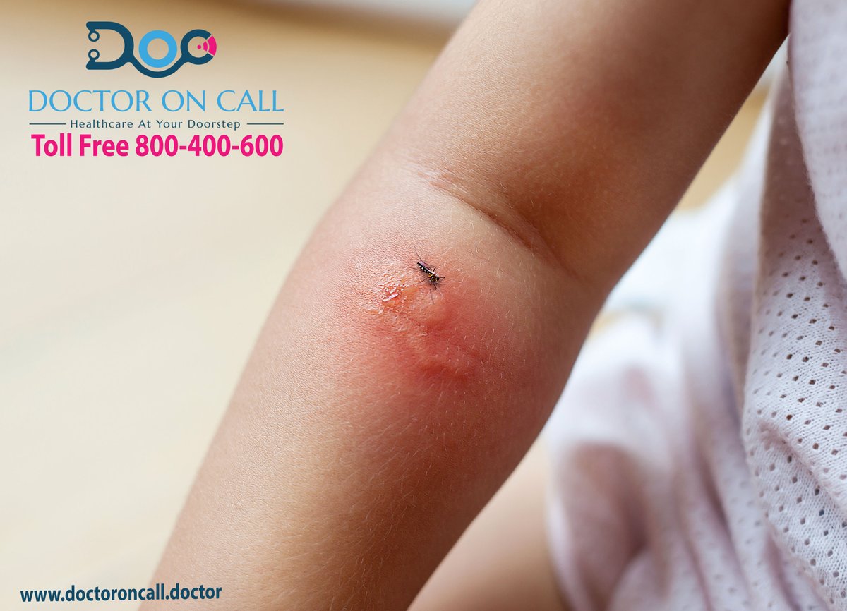 DoctorOnCallHo1's tweet photo. Don't ignore the incident of insect bites or animal bite because it may lead to a life-threatening situation.
Doctor on call to any insect or animal bite to manage it .
#insectbites #doctoroncall #homehealthcare
800-400-600/+97143286166/+971543133183
https://t.co/DVWTCIy4gS https://t.co/yZ9kQWUBTL