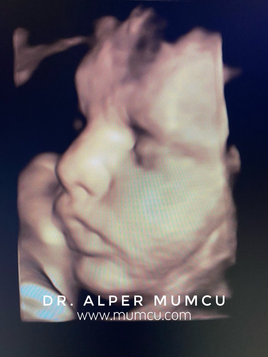 Bebek varsa umut da var. Yaşasın hayat