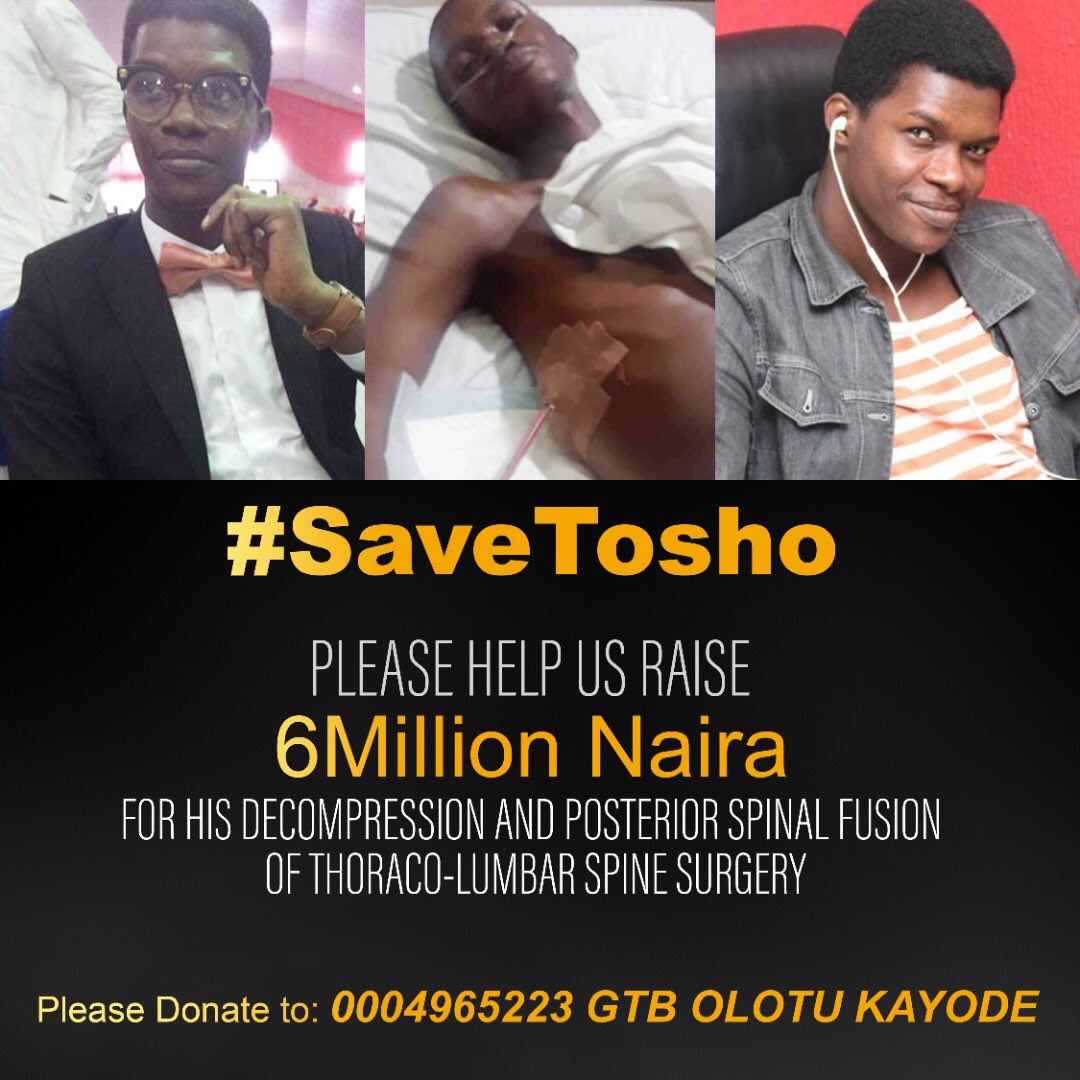 SPARKLYN_SHY's tweet photo. Micheal Omotosho Olotu needs our help guys. He is suffering from Potts disease (Tuberculosis Spondylitis). He needs to undergo surgery urgently.
Your kind donations &amp; generosity to saving Tosho will be well appreciated. Donations can be made to 0004965223 GTB.🙏🙏 @callmeFlaBoy https://t.co/Ex70dpO3NN