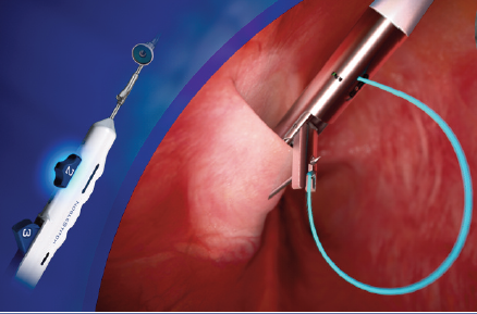 CardiolinkSL's tweet photo. En breve empezará el caso enlatado sobre el cierre del foramen oval permeable (FOP) con #Noblestitch
¡No os lo perdáis!
#PFO #cursoFIC #cardiologia https://t.co/w8DVivw8bc