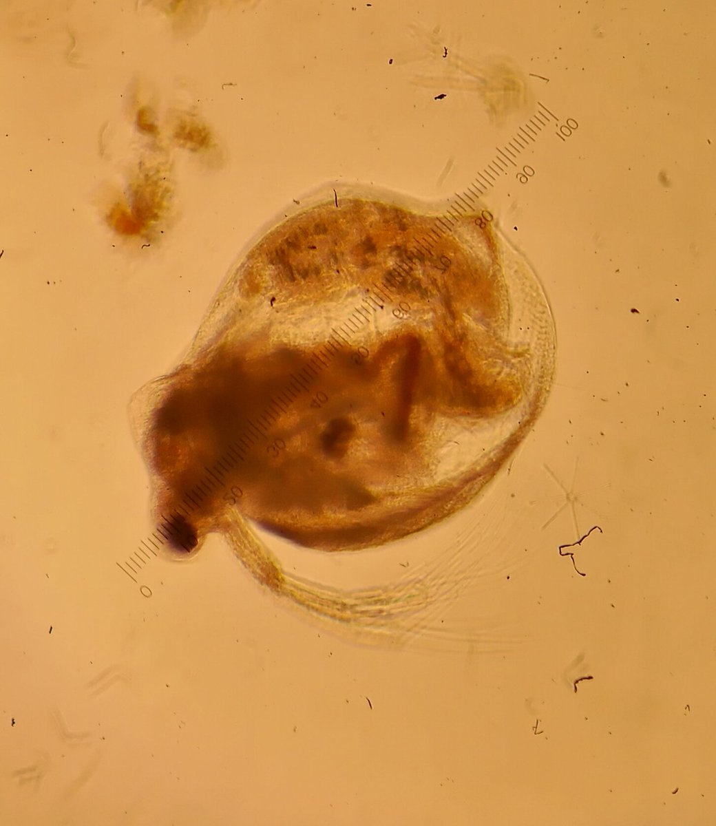 CalderoPM's tweet photo. Winter #Feeagh #zooplankton Gravid #cladocerans #daphnia & #ceriodaphnia and long spines #rotifers #filinia & #kellicottia Also big #diatoms and #allochthonousOM particles https://t.co/QGbyr3U65Z