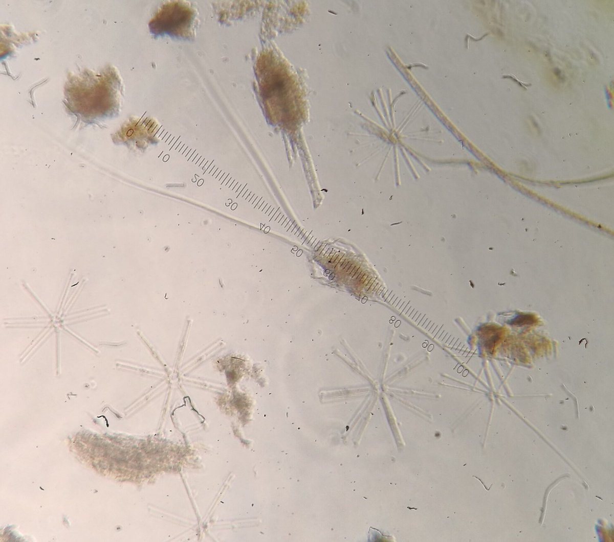 CalderoPM's tweet photo. Winter #Feeagh #zooplankton Gravid #cladocerans #daphnia & #ceriodaphnia and long spines #rotifers #filinia & #kellicottia Also big #diatoms and #allochthonousOM particles https://t.co/QGbyr3U65Z