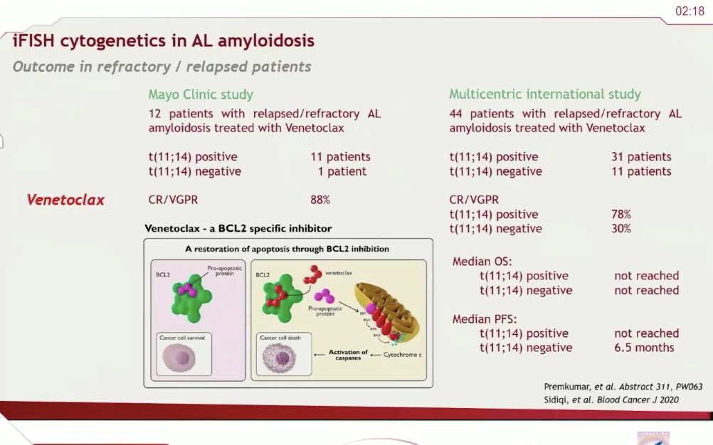 Dr Schönland at  #ISA2020 cytogenetic aberration impact prognosis in AL --> 1q21 gain has poorer prognosis in AL similar to MM. In t(11;14)consider venetoclax ASAP