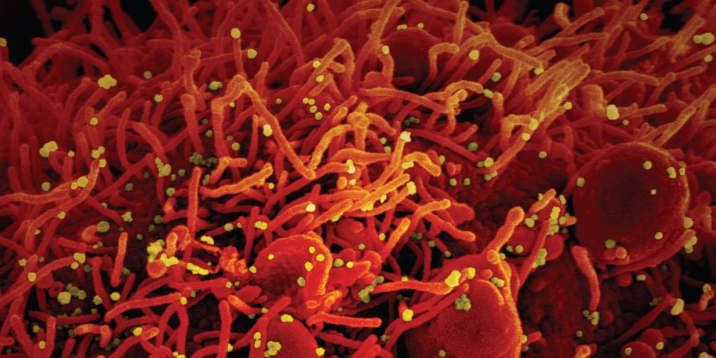 UChicagoMag's tweet photo. While the mysterious new disease spread, UChicago Medicine researchers brought long-held expertise to a new common cause: helping COVID-19 patients. https://t.co/bgj0Wbtj6h https://t.co/ZI4U6ZrFNs