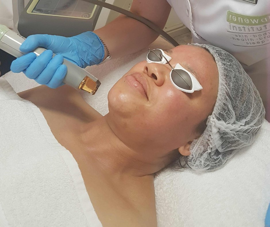 SkinBodyRenewal's tweet photo. For your face, neck, stomach & beyond, loose & dull skin can be treated non-surgically with skin-tightening devices, which offer real results—in record time https://t.co/6cG9BpIcwP
#SkinRenewalSA #skin #skintightening #infrared #RadioFrequency #ExilisElite #Titan #LaserGenesis https://t.co/88qMYUcoUR