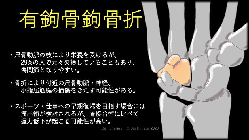 有鉤骨鉤骨折 Hashtag On Twitter
