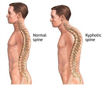 -Decompress the spine:If you sit at a desk for long hours.It's likely you tend to slouch after a while.This puts extra stress on the spinal discs and ligaments.Hanging is a natural decompressor of the spine with the assistance of gravity.Usually feels great after.
