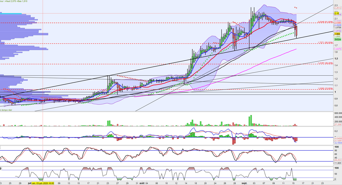 AILLEURS2507's tweet image. #sensorion $alsen