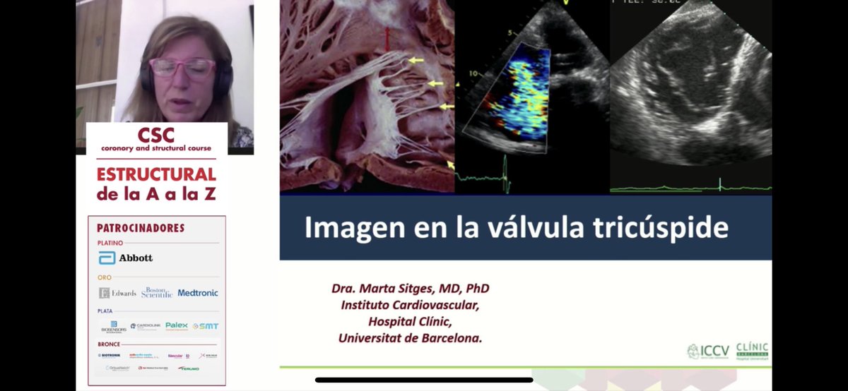 CSC_interv's tweet photo. Seguimos con la #Tricuspide presentando la terapias percutaneas presentes y futuras con gran importancia de la #ImagenMultimodal #Cardioband #Tricvalve #Tricento #Navigate @RodrigoEstvez1 @ignamatsant @icruzgonzalez @ASanchezRecalde @stamdos https://t.co/18VdcW0i6p