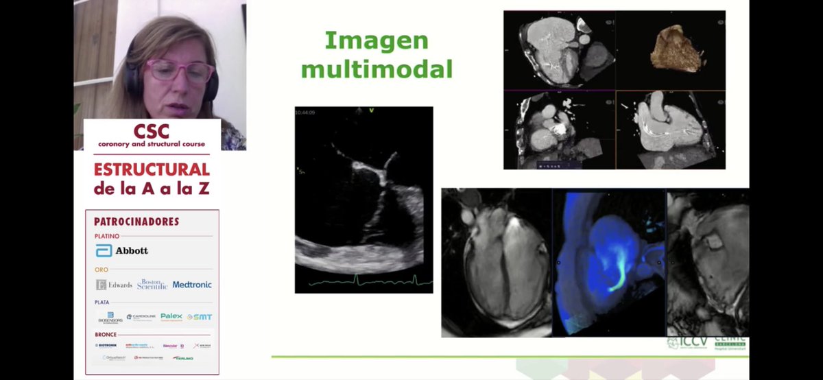 CSC_interv's tweet photo. Seguimos con la #Tricuspide presentando la terapias percutaneas presentes y futuras con gran importancia de la #ImagenMultimodal #Cardioband #Tricvalve #Tricento #Navigate @RodrigoEstvez1 @ignamatsant @icruzgonzalez @ASanchezRecalde @stamdos https://t.co/18VdcW0i6p