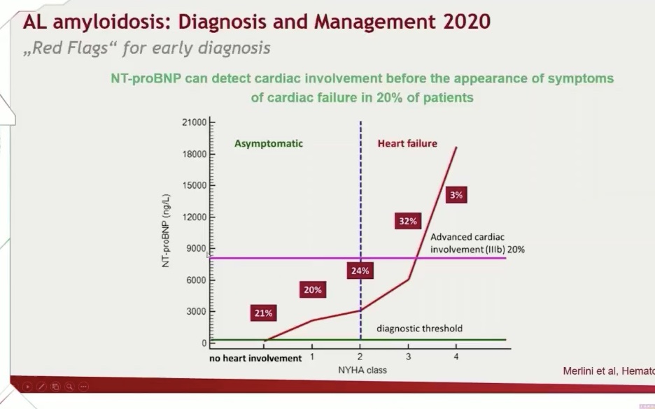 Dr Hegenbart at  #ISA2020 pointed out RED FLAGS for AL  #amyloidosis and suggested NT-proBNP for all patients with MGUS and elevated Free Light Chins. NT-proBNP can detect cardiac involvement before symptoms of heart failure occur in 20% of patients.