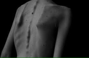 Back: