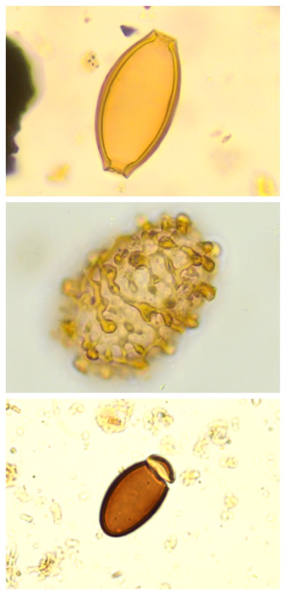 (Post)middeleeuwse Brusselaars werden geplaagd door diarree! 💩😲 #NaturalSciencesBrussels  

Hoe dat komt ontdek je op ➡️ naturalsciences.be/nl/news/item/1… ⬅️

<a href="/BrusselsUrban/">Brussels</a> <a href="/DeforceKoen/">Koen Deforce</a> 
#sciencenews #Brussels #Bruxelles