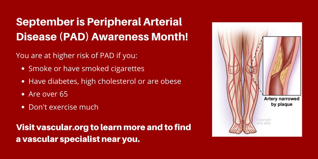 September is Peripheral Arterial Disease (PAD) Month. Utilize the resources on the SVS website to educate your patients this month and beyond. ow.ly/Mt3T50BhaYv