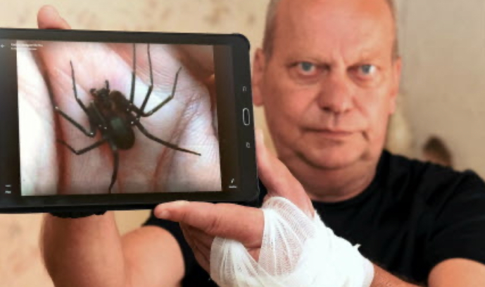 Mediavenir's tweet photo. 🇫🇷 FLASH - Un #homme de 60 ans a été mordu, pendant son #sommeil, par une dangereuse #araignée (Recluse). Il a failli être amputé d’un bras. Quatre #opérations, un mois d’hospitalisation et une #greffe ont permis d’éviter le pire. (Est Rep) #Lorraine https://t.co/LVm9zte0b1