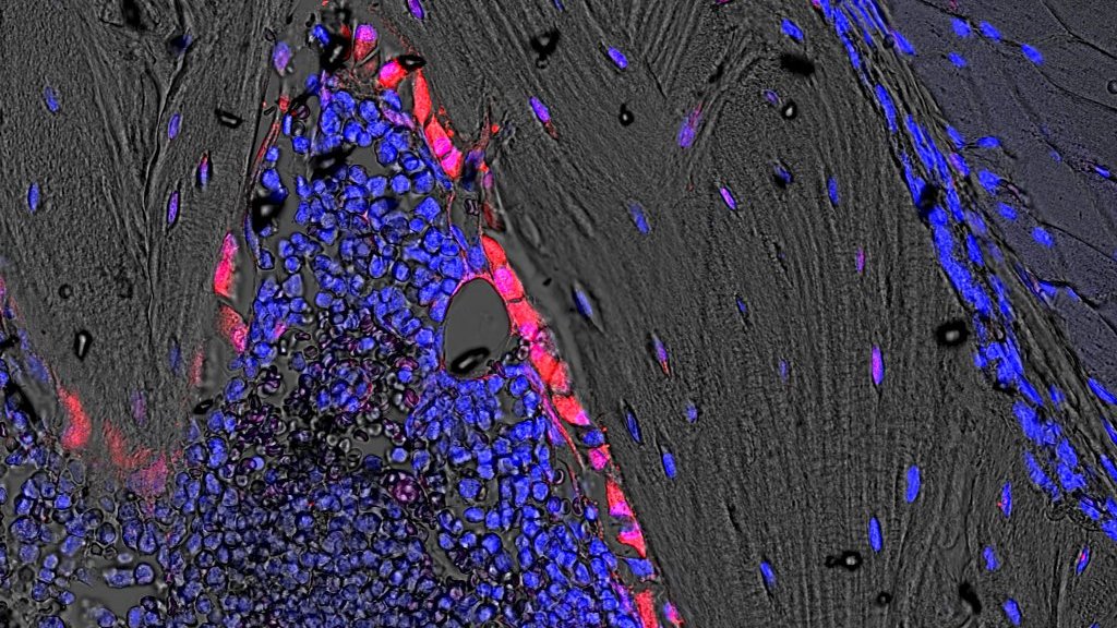 Another good excuse for celebration, delighted to see our paper published!! We started this project with <a href="/JillyJohnson25/">Jilly Johnson</a> when I joined the lab, and it was published on my last day... Thanks to everybody who took part in this work! <a href="/apitsillides50/">Andrew Pitsillides</a> @hoeyd83 
asbmr.onlinelibrary.wiley.com/doi/abs/10.100…